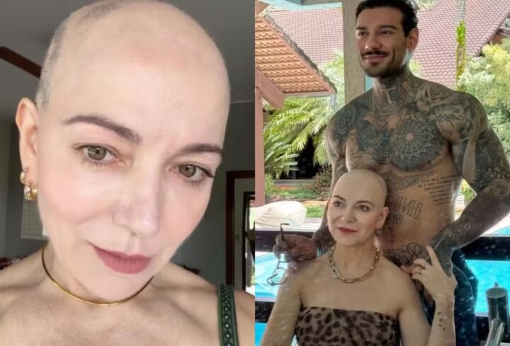 Mãe de Lucas Lucco relembra descoberta da alopecia: ‘Fazia barulho quando o cabelo caía no chão’