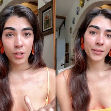 Aos 28 anos, cantora Ananda Paixão é diagnosticada com câncer pela terceira vez