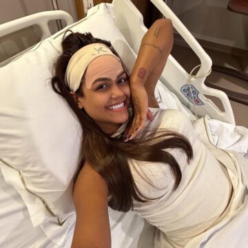 Influenciadora viraliza após fazer cirurgia para remover veia da testa