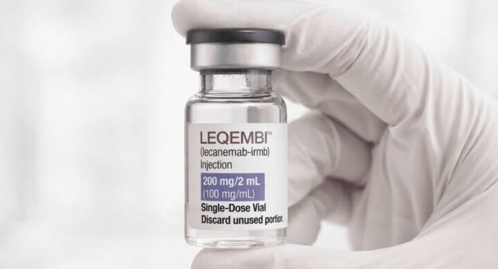 Novo remédio para Alzheimer chega ao Brasil em junho; veja preço e como funciona