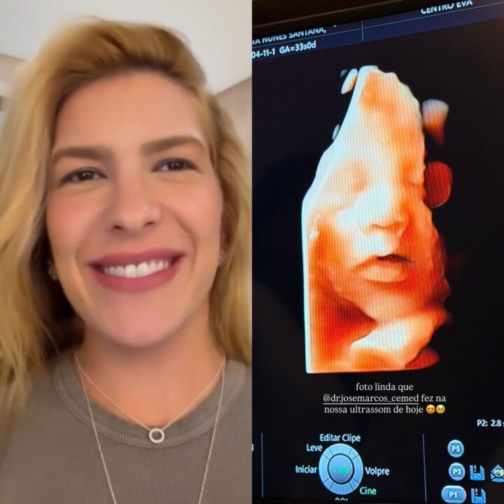 Lore Improta mostra o rosto do filho em ultrassom e constata: ‘A cara de Liz’