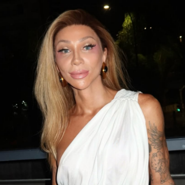 Maya Massafera faz procedimento que “remove a pele” para rejuvenescimento facial