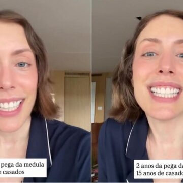 Fabiana Justus comemora após transplante de medula óssea: ‘Meu renascimento’