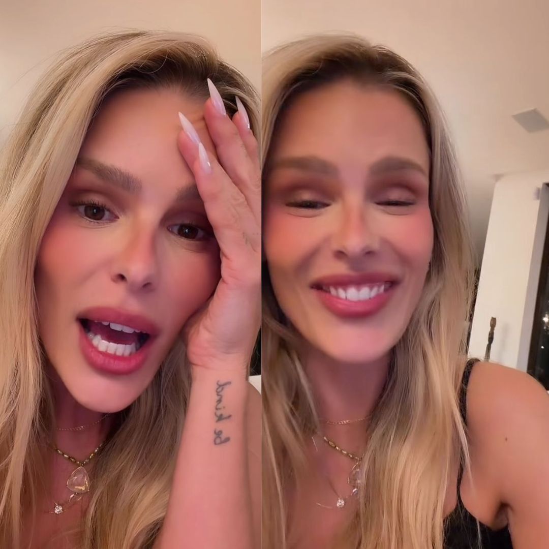 Yasmin Brunet relembra comentário de desconhecido na rua que antecedeu diagnóstico de lipedema
