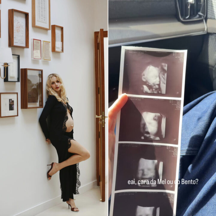 Grávida, filha de Xuxa encanta ao mostrar ultrassom do terceiro filho