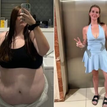 Jovem emagrece 63 quilos sem caneta ou cirurgia; veja estratégia dela