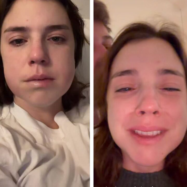 Alice Wegmann surge com rosto inchado na web: ‘desarmonização facial’