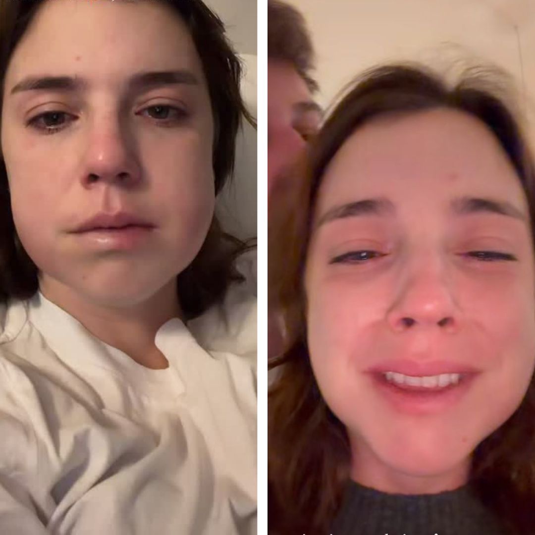 Alice Wegmann surge com rosto inchado na web: ‘desarmonização facial’