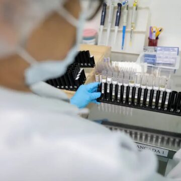 Fiocruz vai produzir medicamento de alto custo contra esclerose múltipla para o SUS