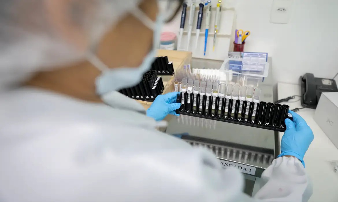 Fiocruz vai produzir medicamento de alto custo contra esclerose múltipla para o SUS