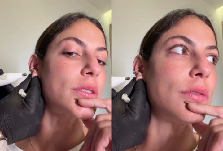 Mari Gonzalez passa por procedimento na orelha e exibe resultado: ‘Estou chocada’