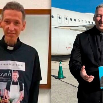 Padre Marcelo Rossi compartilha antes e faz alerta sobre depressão