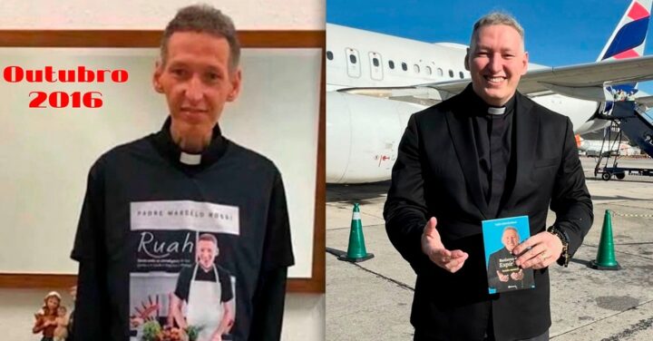 Padre Marcelo Rossi compartilha antes e faz alerta sobre depressão