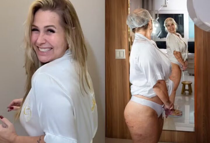Ex-Paquita Andréa Sorvetão perde 20kg e passa por tratamento para celulite