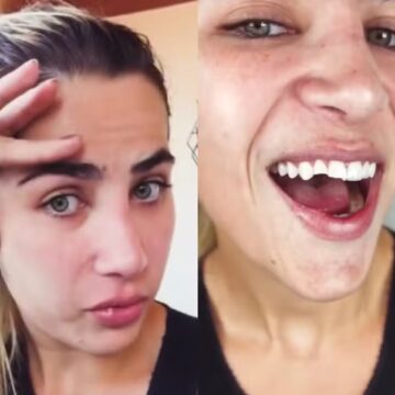 Filha de Leonardo, Jéssica Beatriz Costa quebra dentes após queda e exibe novo sorriso