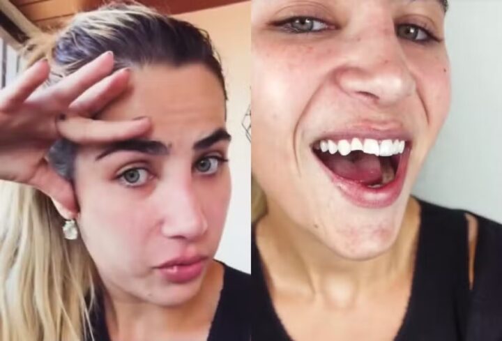 Filha de Leonardo, Jéssica Beatriz Costa quebra dentes após queda e exibe novo sorriso