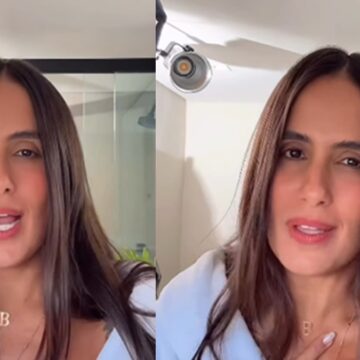 Carol Peixinho inicia remoção de tatuagem feita há 11 anos e desabafa: ‘Nunca gostei do resultado’