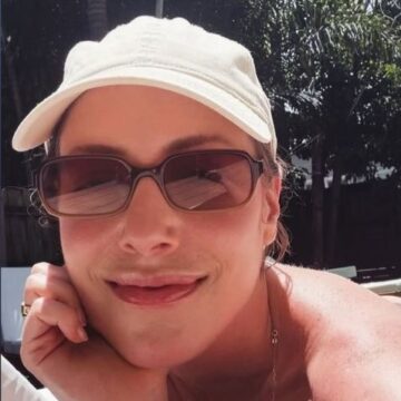 Fabiana Justus volta a tomar sol após tratamento contra leucemia: ‘Indescritível’