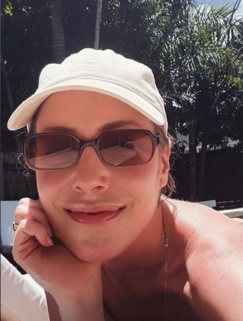 Fabiana Justus volta a tomar sol após tratamento contra leucemia: ‘Indescritível’