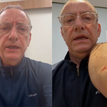 Jornalista da Globo relata susto após ser atacado por pitbull e levar quatro pontos na mão