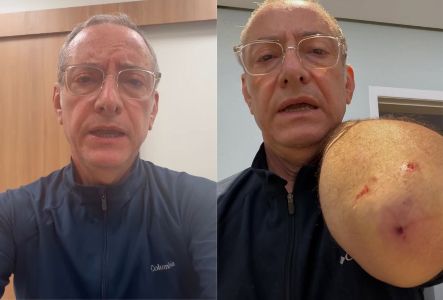 Jornalista da Globo relata susto após ser atacado por pitbull e levar quatro pontos na mão