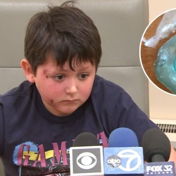 Desafio com brinquedo viral preocupa médicos e pais após queimaduras graves em crianças