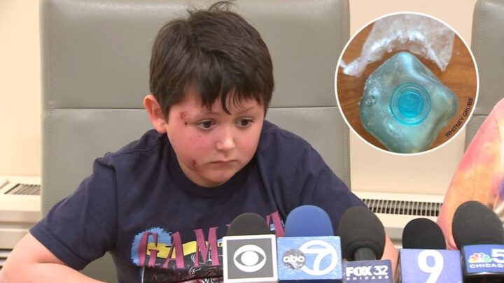 Desafio com brinquedo viral preocupa médicos e pais após queimaduras graves em crianças