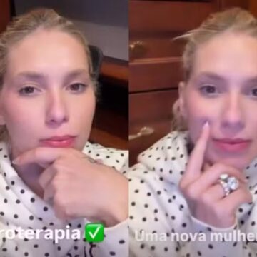 Soroterapia de Virginia Fonseca: entenda o que a ciência diz sobre o tratamento