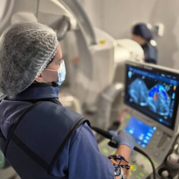 Hospital Martagão Gesteira realiza procedimento inédito para tratar cardiopatia em crianças e adolescentes