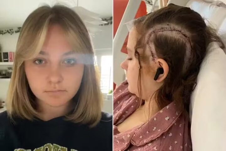 Adolescente se torna paciente mais jovem a passar por cirurgia cerebral acordada