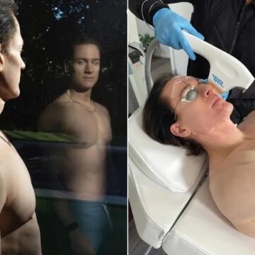 Após ‘se clonar’, biohacker tenta voltar aos 18 anos: ‘Me pergunto se não fui longe demais’