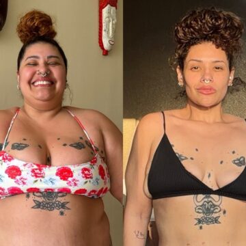 Cantora Aila Menezes exibe antes e depois após perder 90 kg e faz desabafo: “Meu corpo gordo me salvou”
