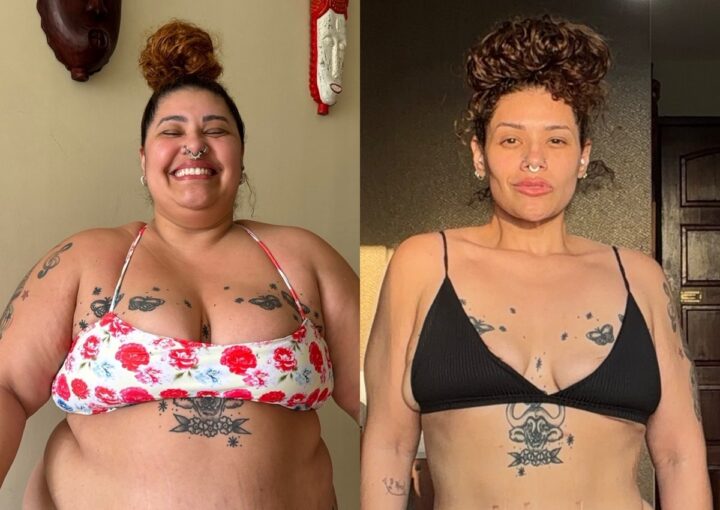 Cantora Aila Menezes exibe antes e depois após perder 90 kg e faz desabafo: “Meu corpo gordo me salvou”