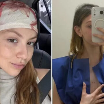 Diagnosticada com câncer, neta de Carlos Alberto de Nóbrega desabafa após primeira radioterapia: ‘Chorei o dia todo’