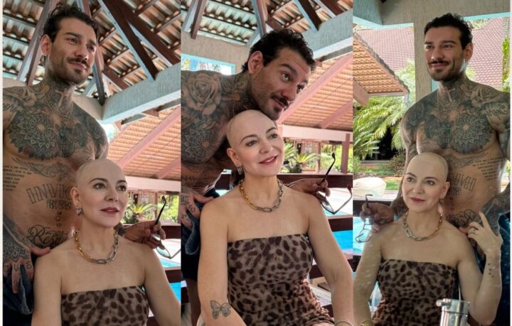 Careca, mãe de Lucas Lucco desabafa sobre fases da doença autoimune: ‘Sinto falta do meu cabelo’
