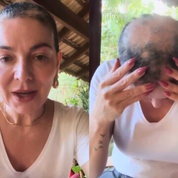Mãe de Lucas Lucco emociona ao desabafar sobre retorno da alopecia: ‘Mais triste’