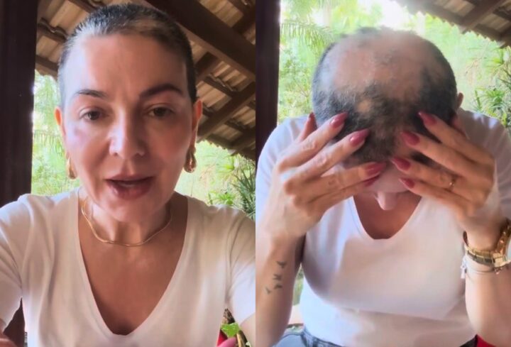 Mãe de Lucas Lucco emociona ao desabafar sobre retorno da alopecia: ‘Mais triste’