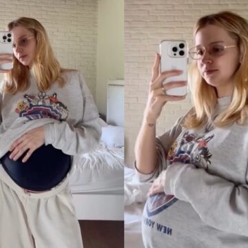 Grávida, filha de Xuxa  é diagnosticada com diabetes e inicia tratamento com insulina: ‘Fiquei abalada’