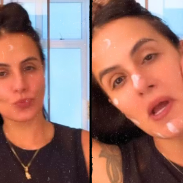 Carol Peixinho revela mudança na rotina e celebra dois anos sem botox