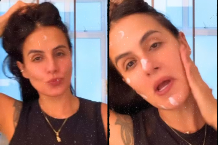 Carol Peixinho revela mudança na rotina e celebra dois anos sem botox