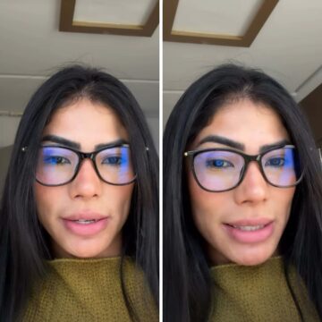Ex-BBB Marciele revela diagnóstico de alopecia e fala de tratamento: ‘Não tá caindo’