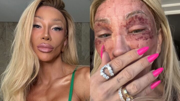 Maya Massafera atualiza estado de saúde e choca ao mostrar rosto: ‘Não consigo rir’