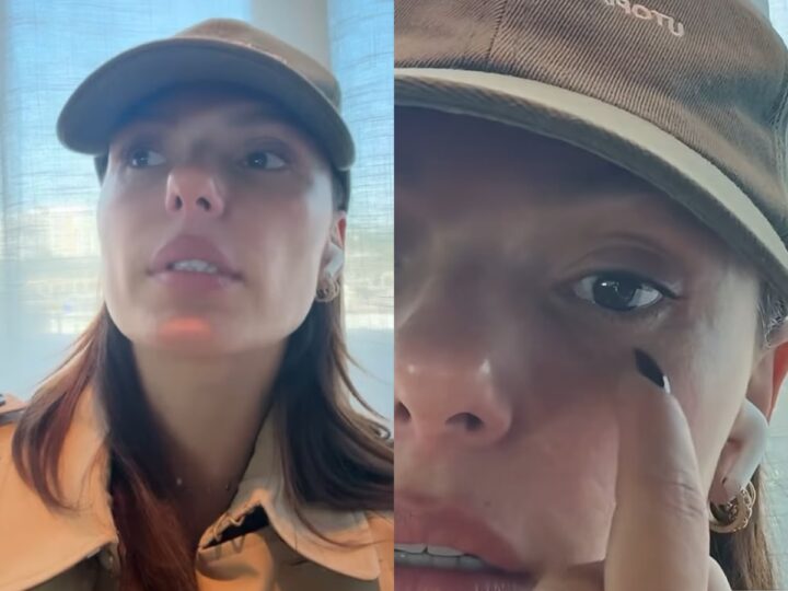 Com doença autoimune, Isis Valverde sofre mal estar e faz alerta aos seguidores: “É uma questão delicada”