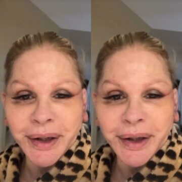 Monique Evans faz cirurgia no rosto e passa por situação inusitada com reconhecimento facial do banco