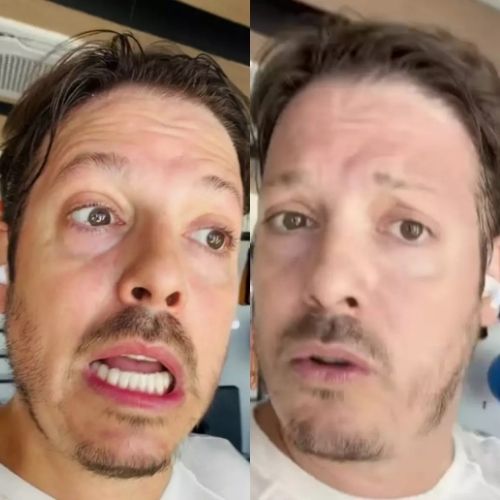 Fábio Porchat revela como retomou rotina após lipoaspiração e admite arrependimento