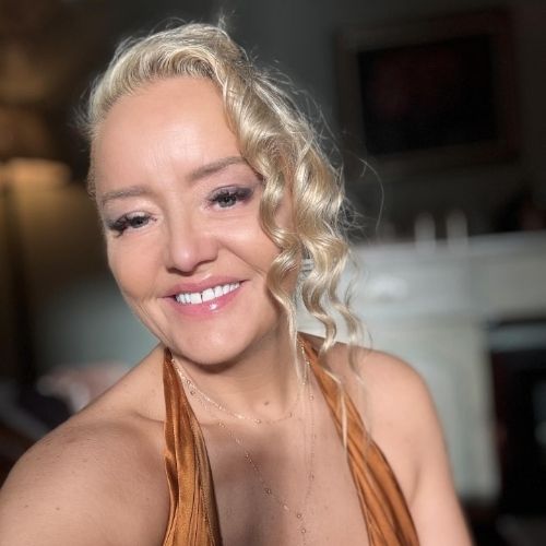 Qual é o câncer da atriz de ‘The Office’? Entenda a doença de Lucy Davis