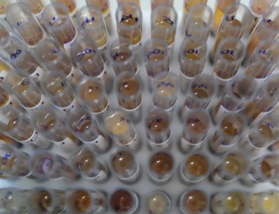 Uso de medicamento oferecido no SUS reduz casos de malária no Brasil