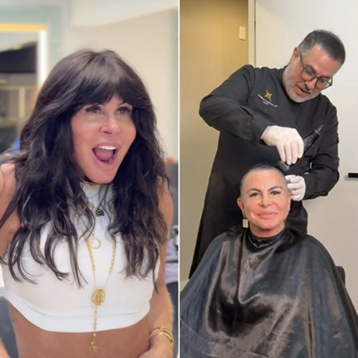 Aos 67 anos, Gretchen raspa a cabeça antes de transplante capilar e revela luta contra alopecia agressiva