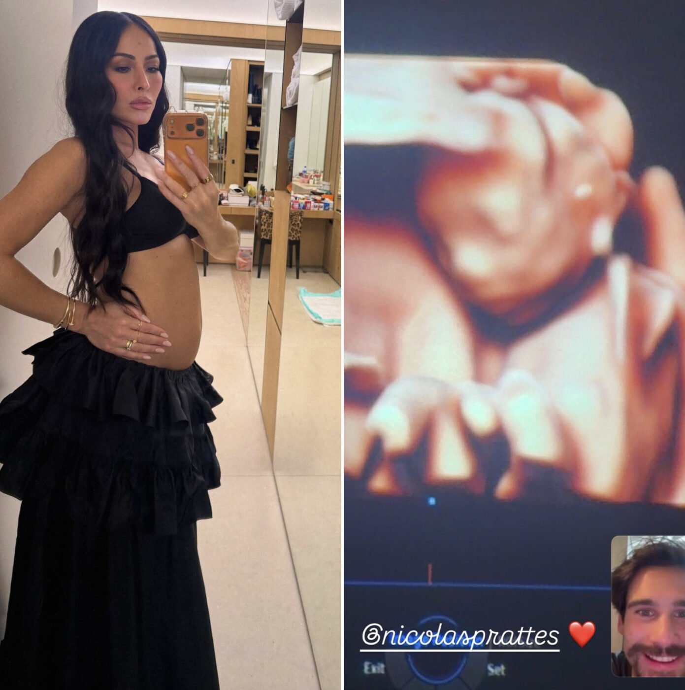 Grávida, Sabrina Sato mostra reação de Nicolas Prattes ao ver o rosto do filho em ultrassom