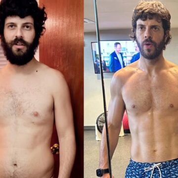 Aos 35 anos, humorista impressiona ao mostrar antes e depois do corpo após remover tumor na pálpebra